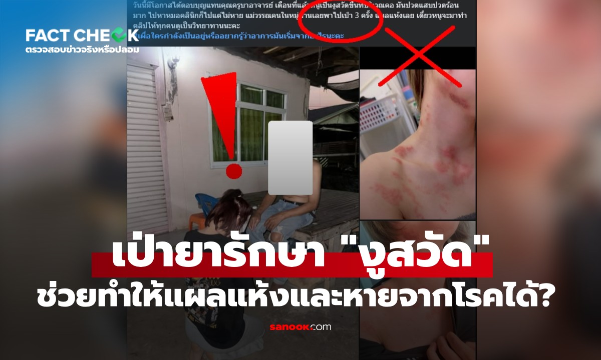 Лечение опоясывающего лишая в Таиланде: традиционные методы и научный взгляд